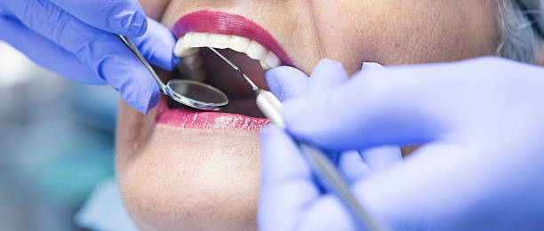 Best Emergency Tooth Extraction in Western Springs, IL